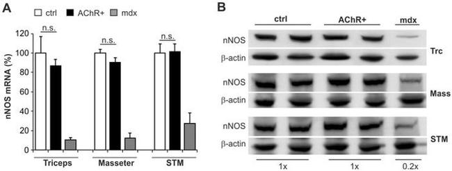 nNOS Antibody in Western Blot (WB)