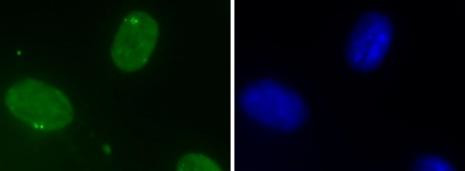 DHX9 Antibody in Immunocytochemistry (ICC/IF)