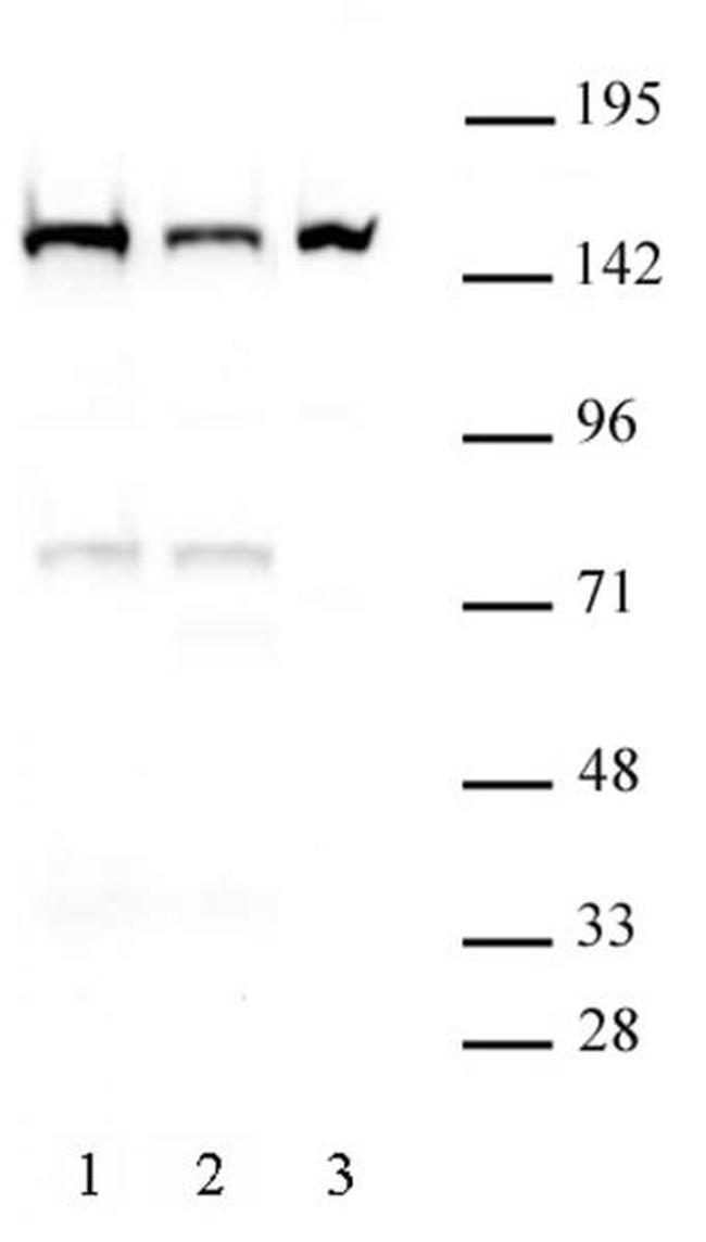 DHX9 Antibody in Western Blot (WB)