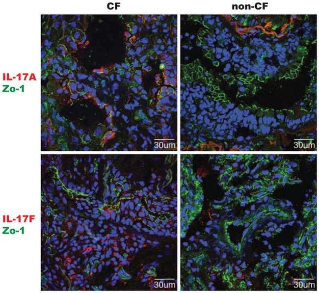 IL-17A Antibody in Immunocytochemistry (ICC/IF)