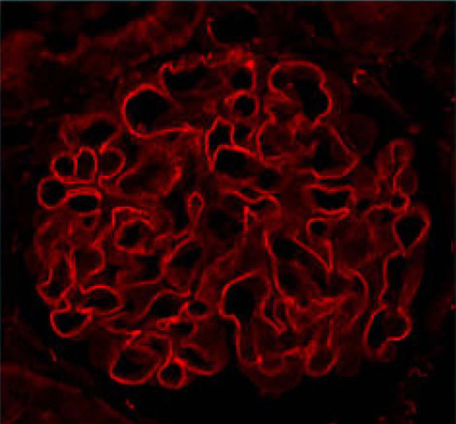 ZO-1 Antibody in Immunohistochemistry (IHC)