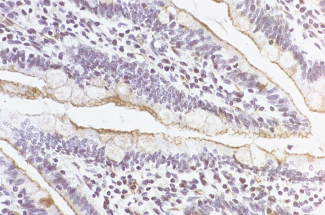 ZO-1 Antibody in Immunohistochemistry (IHC)