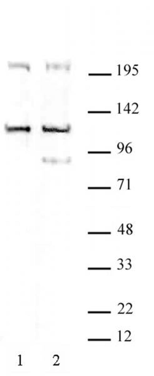 TRIM37 Antibody in Western Blot (WB)