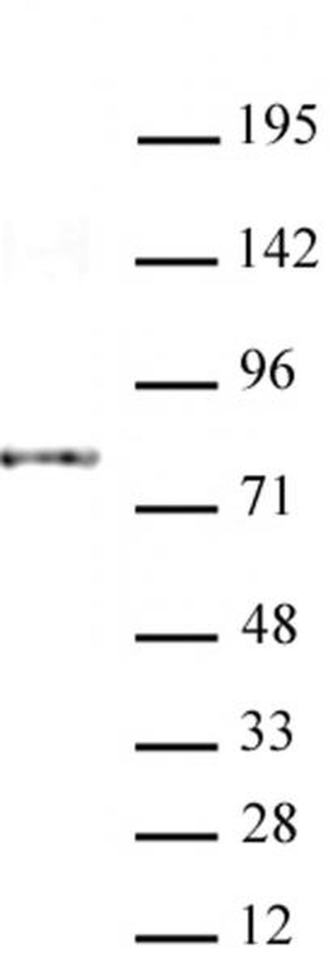 AATF / Che-1 Antibody in Western Blot (WB)