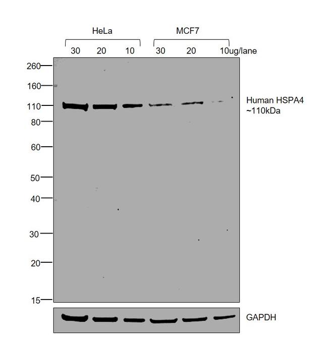 Human IgG (Gamma chain) Cross-Adsorbed Secondary Antibody in Western Blot (WB)