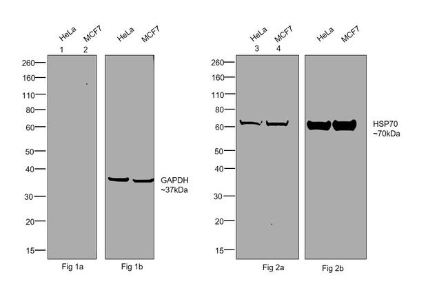 Human IgG (Gamma chain) Cross-Adsorbed Secondary Antibody in Western Blot (WB)