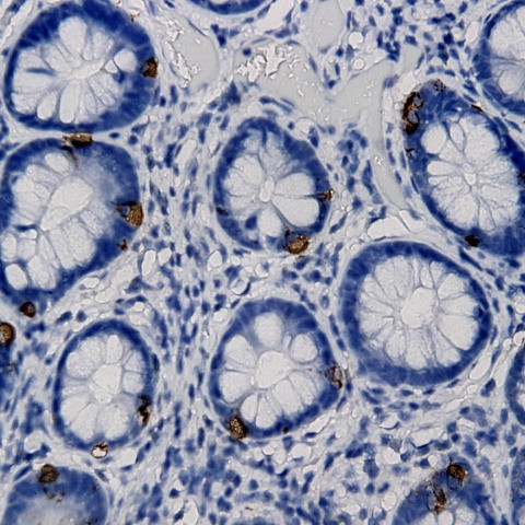 Neuropilin-1 Antibody in Immunohistochemistry (Paraffin) (IHC (P))