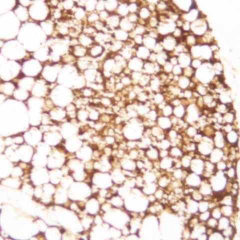 SSEA3 Antibody in Immunohistochemistry (Paraffin) (IHC (P))