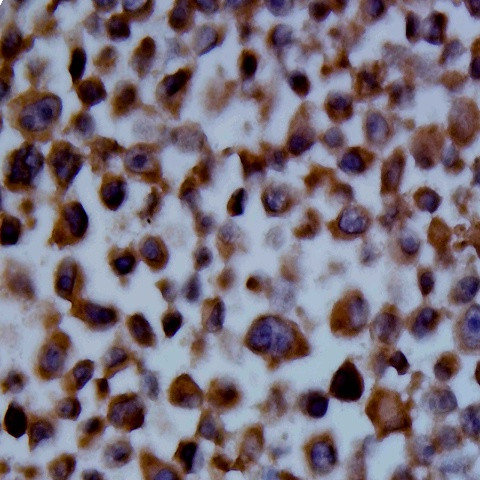 SSEA4 Antibody in Immunocytochemistry (ICC/IF)