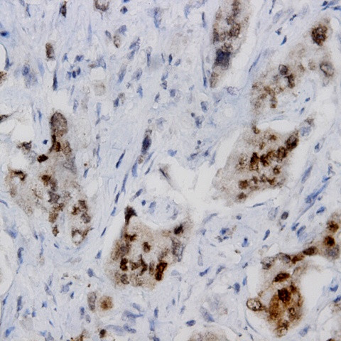 VIR Antibody in Immunohistochemistry (Paraffin) (IHC (P))