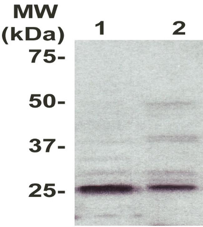 Phospho-RhoGDI (Tyr156) Antibody in Western Blot (WB)