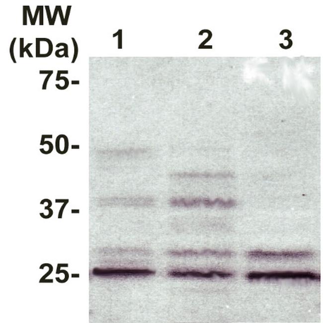 RhoGDI Antibody in Western Blot (WB)