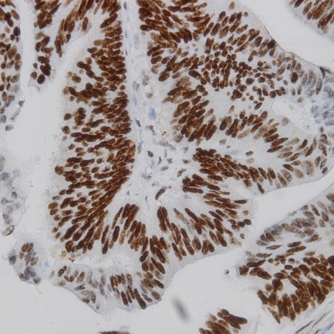 IKK-a Antibody in Immunohistochemistry (Paraffin) (IHC (P))