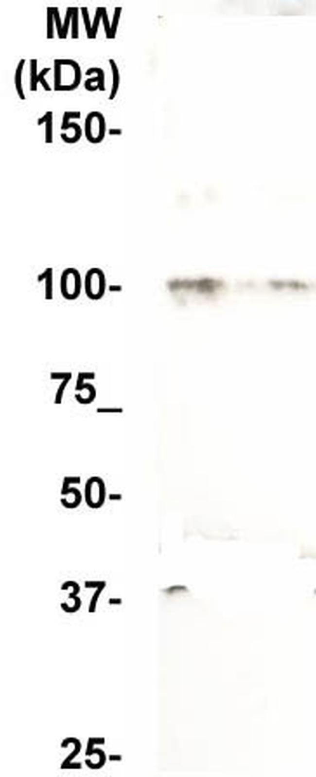 KIF6 Antibody in Western Blot (WB)
