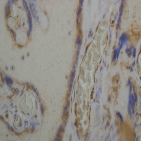 Phospho-TGFBR1 (Ser187, Ser189, Ser191) Antibody in Immunohistochemistry (Paraffin) (IHC (P))