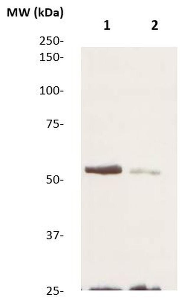 Phospho-TGFBR1 (Ser187, Ser189, Ser191) Antibody in Western Blot (WB)