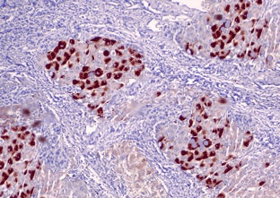 Phospho-TGFBR1 (Ser165) Antibody in Immunohistochemistry (Paraffin) (IHC (P))