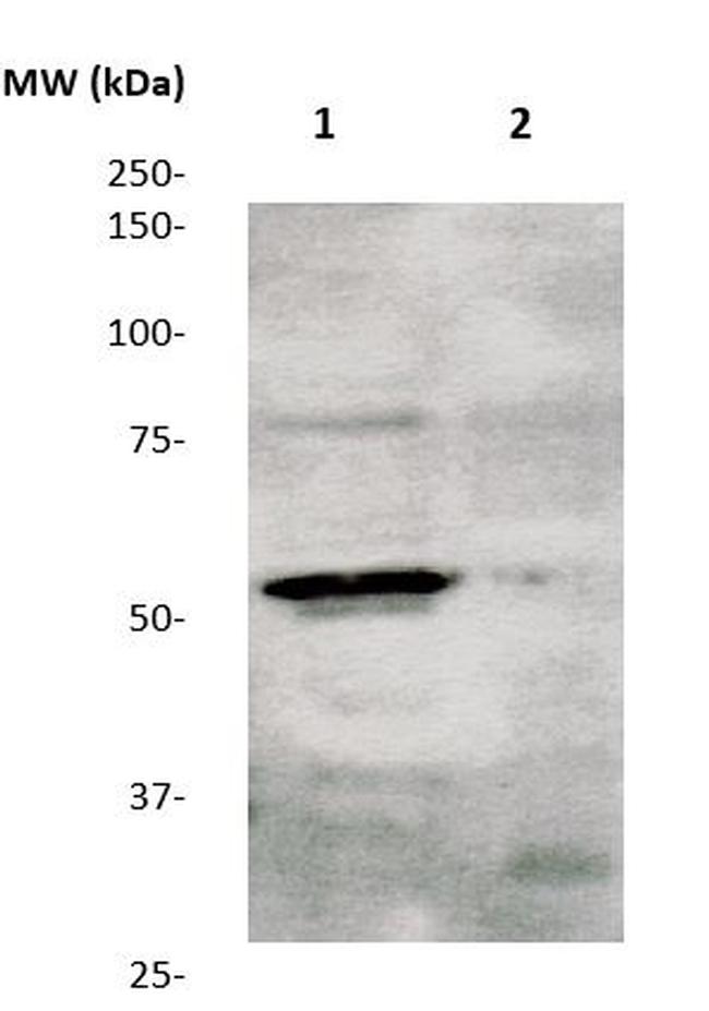 Phospho-TGFBR1 (Ser165) Antibody in Western Blot (WB)