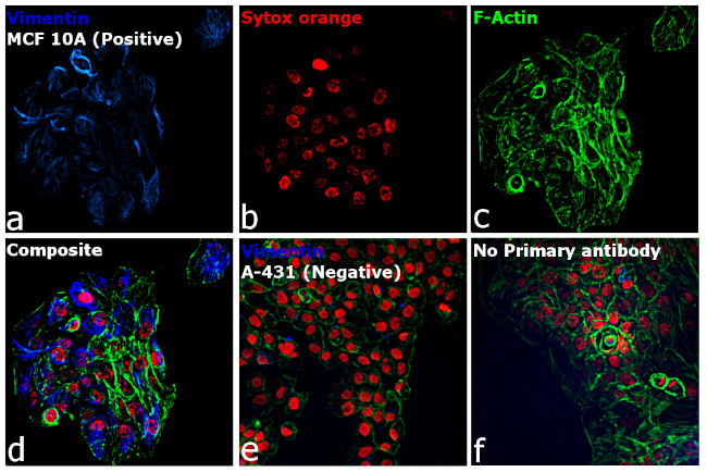 Rabbit IgG (H+L) Secondary Antibody in Immunocytochemistry (ICC/IF)