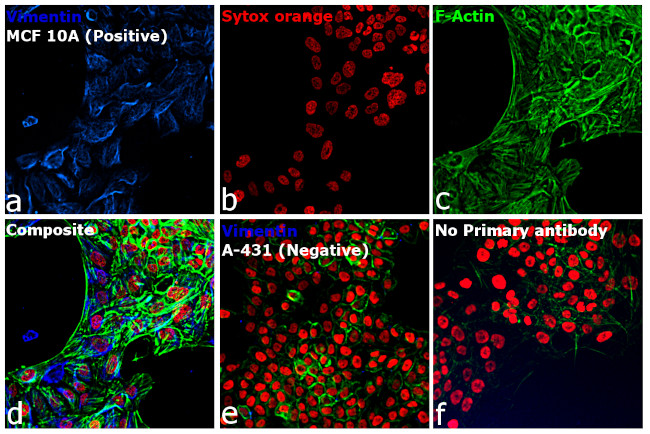 Rabbit IgG (H+L) Cross-Adsorbed Secondary Antibody in Immunocytochemistry (ICC/IF)