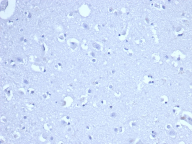 Ribonucleotide Reductase M1/RRM1 Antibody in Immunohistochemistry (Paraffin) (IHC (P))