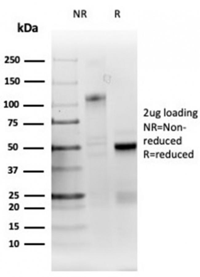 Ribonucleotide Reductase M1/RRM1 Antibody in SDS-PAGE (SDS-PAGE)