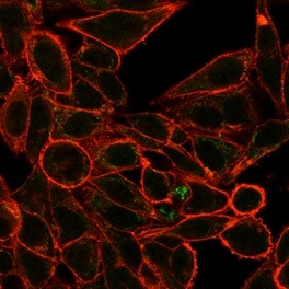 RXRG/NR2B3 (Transcription Factor) Antibody in Immunocytochemistry (ICC/IF)