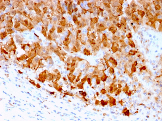 S100A1 Antibody in Immunohistochemistry (Paraffin) (IHC (P))