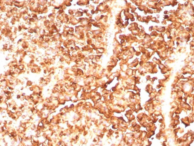 S100A1 (Melanoma Marker) Antibody in Immunohistochemistry (Paraffin) (IHC (P))