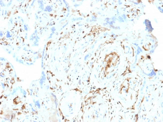 S100A2/S100 Calcium Binding Protein A2 Antibody in Immunohistochemistry (Paraffin) (IHC (P))