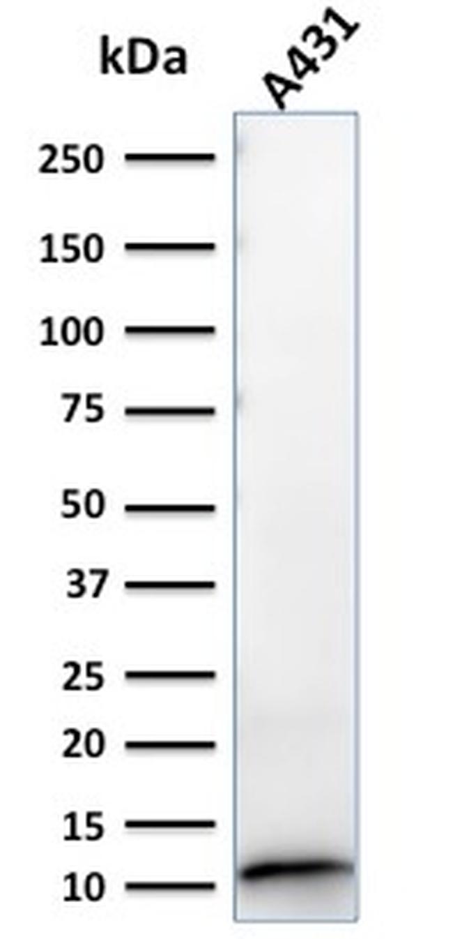 S100A2/S100 Calcium Binding Protein A2 Antibody in Western Blot (WB)