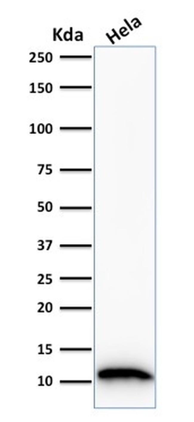 S100A4/Metastasin/Calvasculin Antibody in Western Blot (WB)