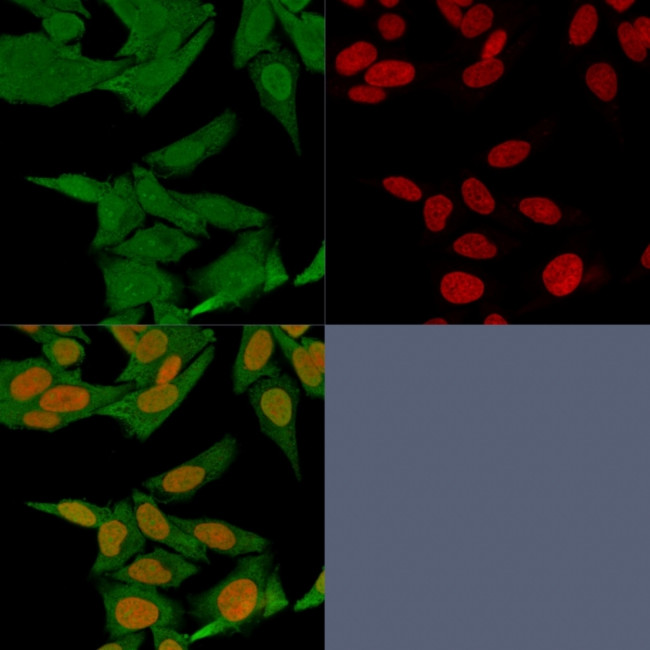 S100A4/Metastasin/Calvasculin Antibody in Immunocytochemistry (ICC/IF)