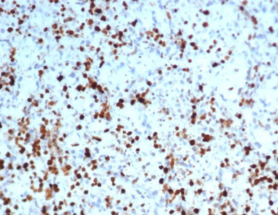 S100A4/Metastasin/Calvasculin (Marker of Tumor Metastasis) Antibody in Immunohistochemistry (Paraffin) (IHC (P))