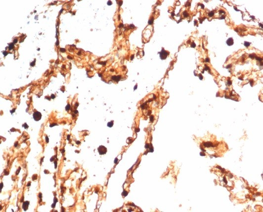 S100A4/Metastasin/Calvasculin (Marker of Tumor Metastasis) Antibody in Immunohistochemistry (Paraffin) (IHC (P))