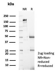 S100A4/Metastasin/Calvasculin (Marker of Tumor Metastasis) Antibody in SDS-PAGE (SDS-PAGE)