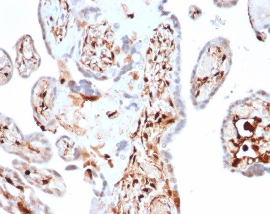 S100A4/Metastasin/Calvasculin (Marker of Tumor Metastasis) Antibody in Immunohistochemistry (Paraffin) (IHC (P))