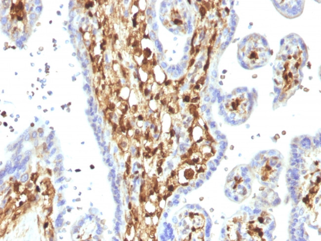 S100A4/Metastasin/Calvasculin (Marker of Tumor Metastasis) Antibody in Immunohistochemistry (Paraffin) (IHC (P))