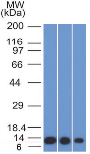 S100A4/Metastasin/Calvasculin (Marker of Tumor Metastasis) Antibody in Western Blot (WB)