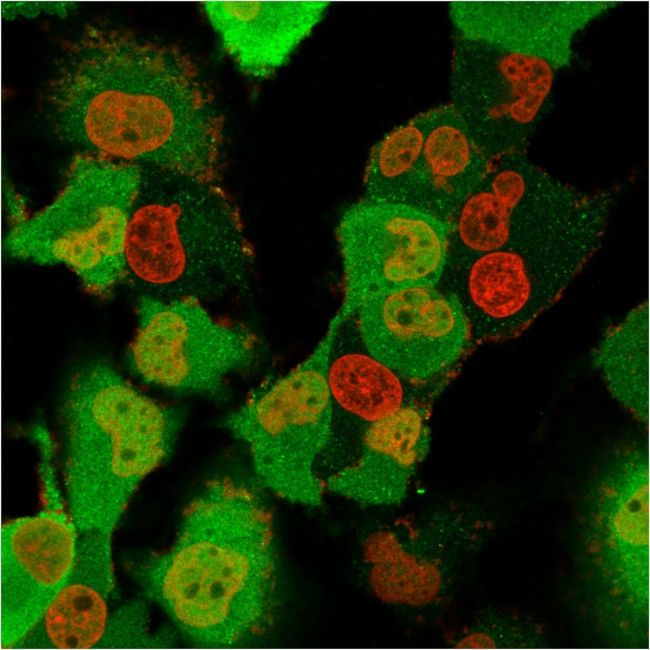 S100A4/Metastasin/Calvasculin (Marker of Tumor Metastasis) Antibody in Immunocytochemistry (ICC/IF)