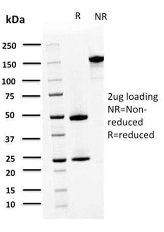 S100A4/Metastasin/Calvasculin (Marker of Tumor Metastasis) Antibody in SDS-PAGE (SDS-PAGE)