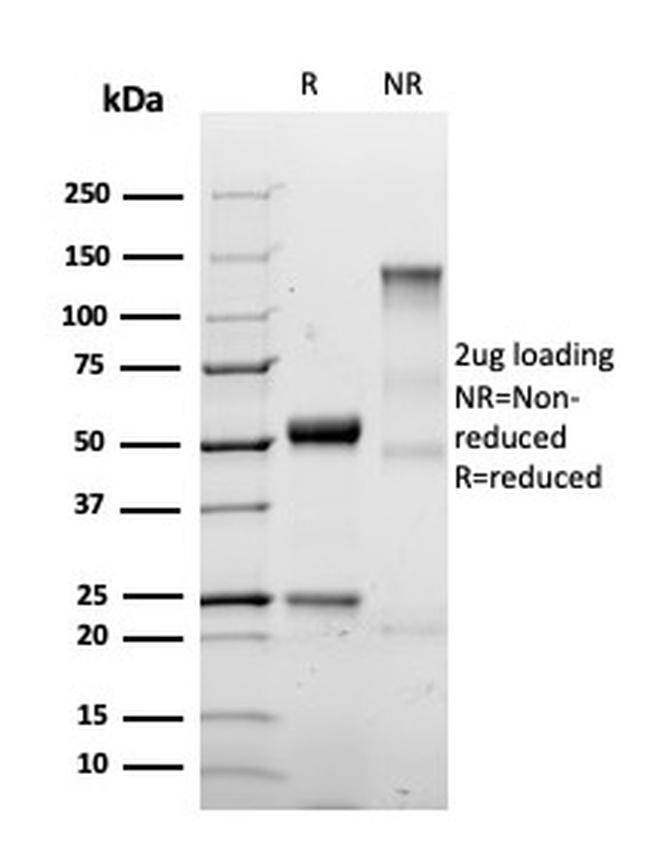 S100A4/Metastasin/Calvasculin Antibody in SDS-PAGE (SDS-PAGE)