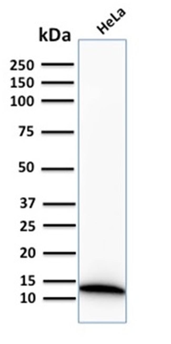 S100A4/Metastasin/Calvasculin Antibody in Western Blot (WB)