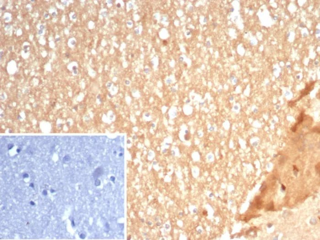 S100A5 Antibody in Immunohistochemistry (Paraffin) (IHC (P))