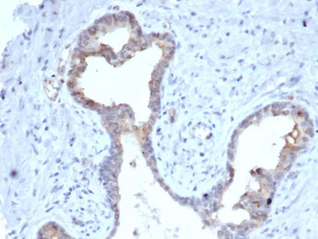 S100A5 Antibody in Immunohistochemistry (Paraffin) (IHC (P))