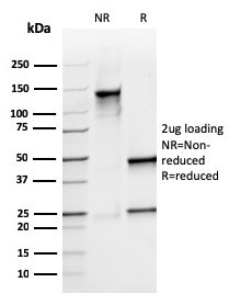 Calprotectin/MRP14/S100A9/Calgranulin B Antibody in SDS-PAGE (SDS-PAGE)