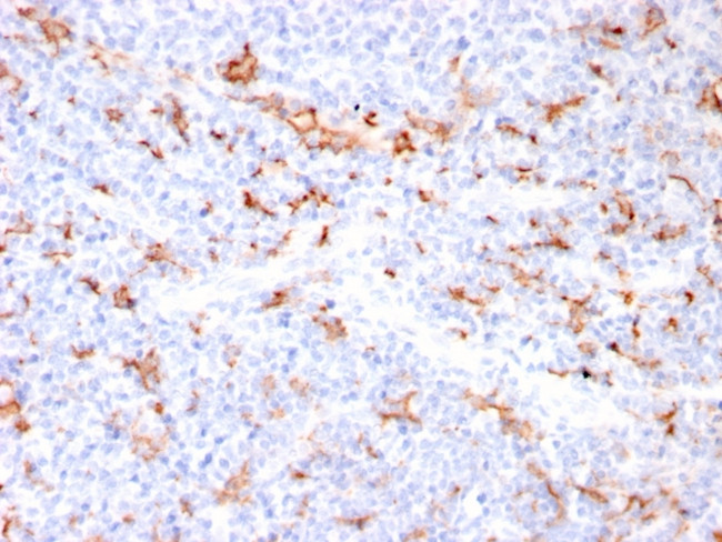 S100A9 + Calprotectin (S100A8/A9 Complex) Antibody in Immunohistochemistry (Paraffin) (IHC (P))