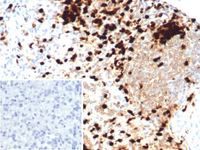 Calprotectin/MRP14/S100A9/Calgranulin B Antibody in Immunohistochemistry (Paraffin) (IHC (P))