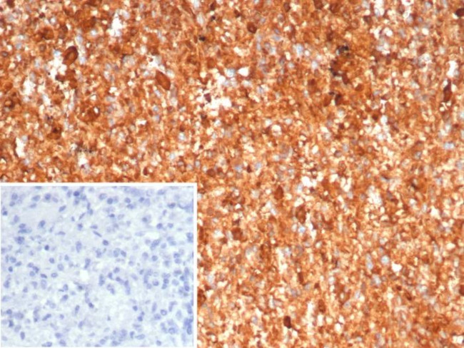 Calprotectin/MRP14/S100A9/Calgranulin B Antibody in Immunohistochemistry (Paraffin) (IHC (P))