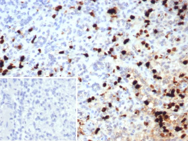 Calprotectin/MRP14/S100A9/Calgranulin B Antibody in Immunohistochemistry (Paraffin) (IHC (P))